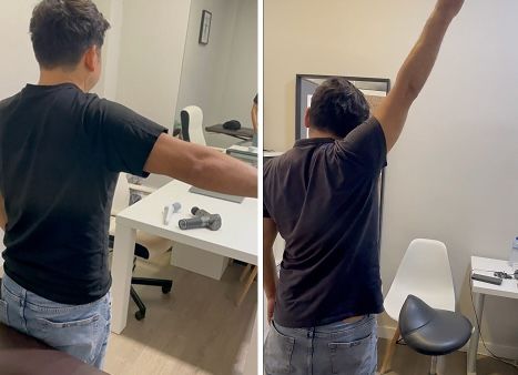 Antes y despues 7