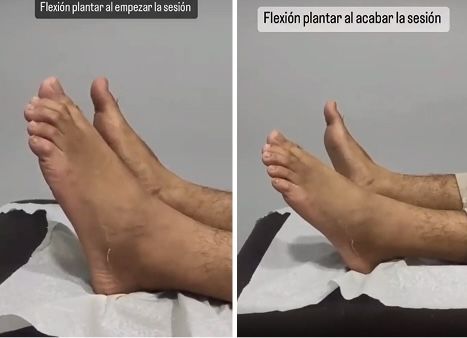 Antes y despues 9